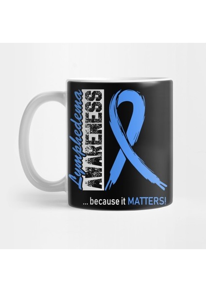 Lymphedema Awareness Because It Matters Kupa Bardak