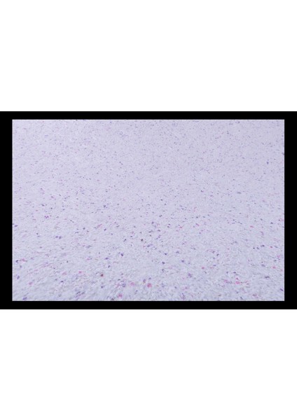 Canlı Sıva | Ipek Sıva | Dekoratif Sıva |sunshine 25 | Beyaz Zemin Bordo Mor Fuşya Desen 1/2 PAKET