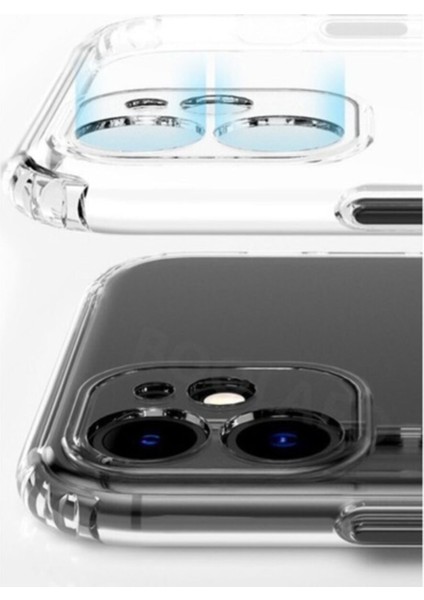 Xiaomi Redmi Note 10S Tıpalı Kamera Korumalı Şeffaf Premier Kılıf